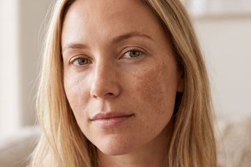 The best serum for pigmentation and dark spots during pregnancy